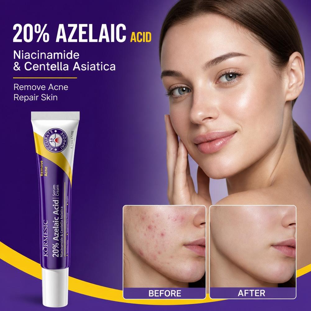 20% Azelaic Acid essence Deep  - Luxury Skincare Brands review and price